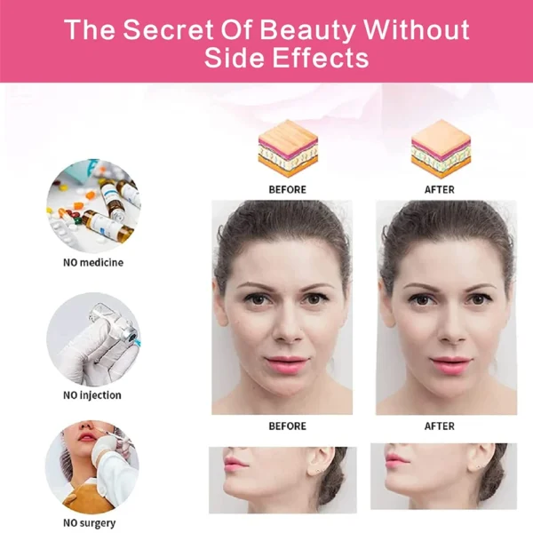 Double Chin Reducer Strap - Reusable V-Line Face Lifting Belt for Women, Elastic Slimming Bandage for Facial Wrinkle Reduction - Image 4