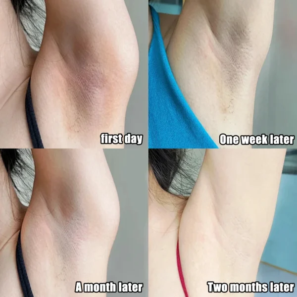 Whitening Cream for Dark Skin – Underarm, Armpit & Intimate Area Lightening Moisturizer | Korean Skincare - Image 2
