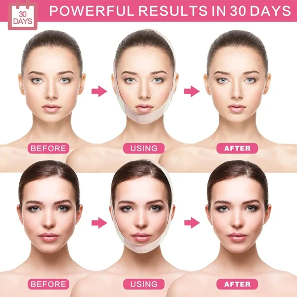 Double Chin Reducer Strap - Reusable V-Line Face Lifting Belt for Women, Elastic Slimming Bandage for Facial Wrinkle Reduction - Image 6