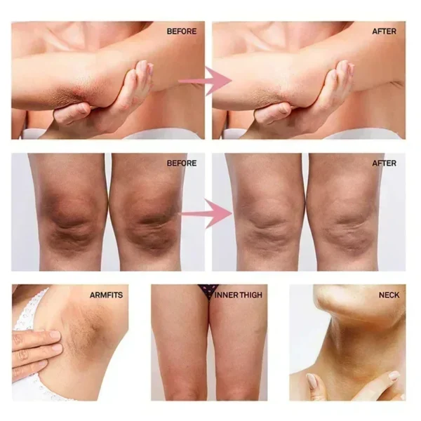 Whitening Cream for Dark Skin – Underarm, Armpit & Intimate Area Lightening Moisturizer | Korean Skincare - Image 3